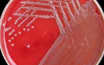 Инфекции, вызванные Acinetobacter