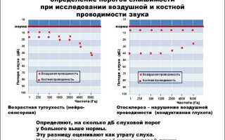 Аудиограмма слуха: что это такое, норма, расшифровка