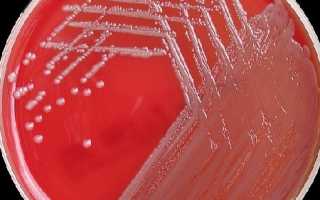 Инфекции, вызванные Acinetobacter