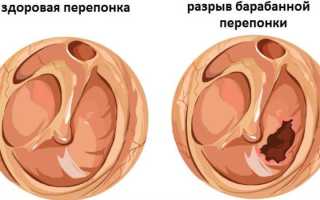 Почему выходит воздух из уха