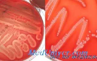 Mrsa инфекция что это такое